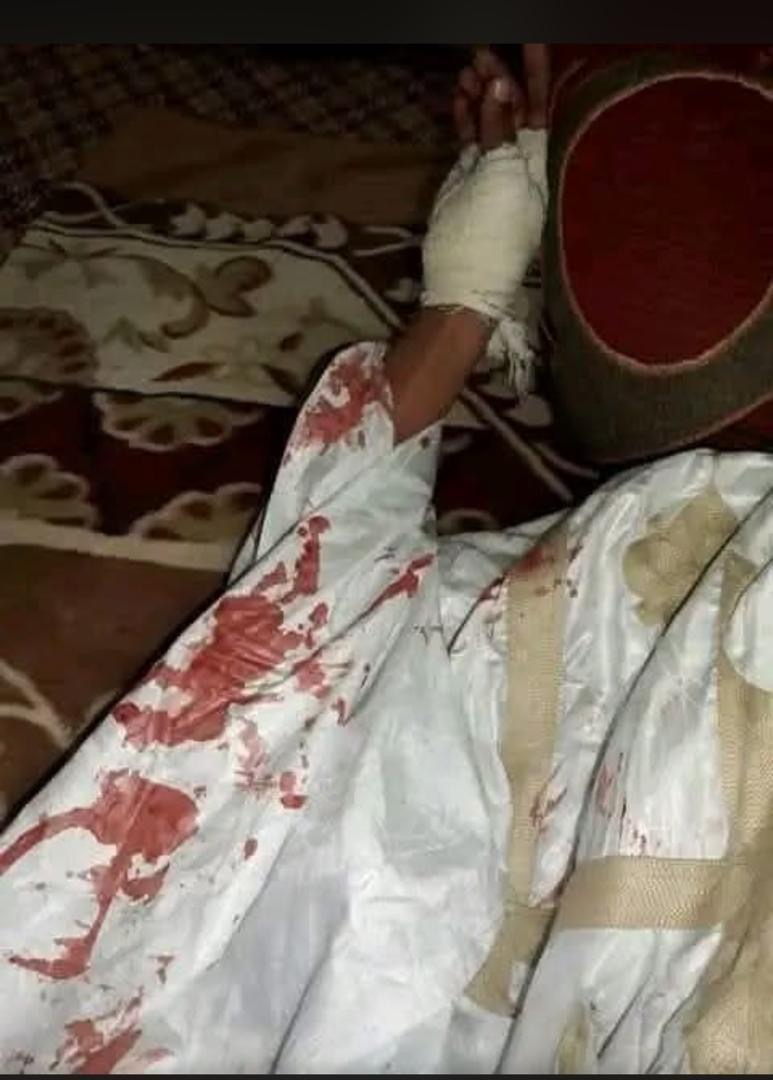 Nouakchott / Agression à l’arme blanche près d’une mosquée