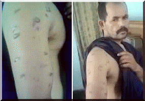 MCM : La vie d’un travailleur menacée après avoir été fortement touché par une importante ...